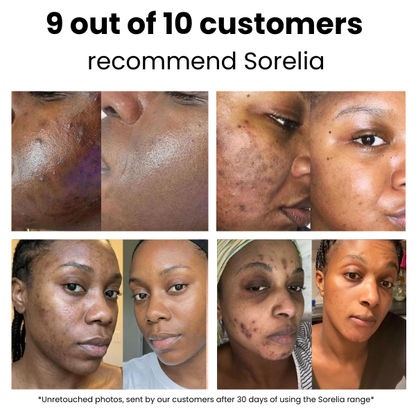 Sorelia Turmeric Fade Pads