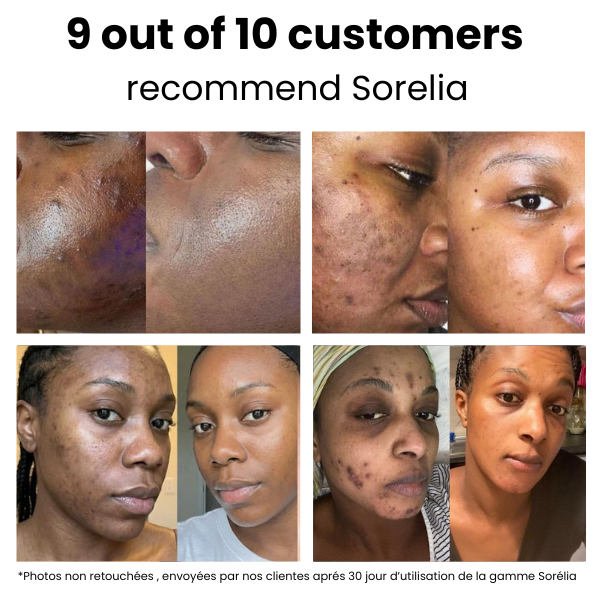 Turmeric Hydrating Cream